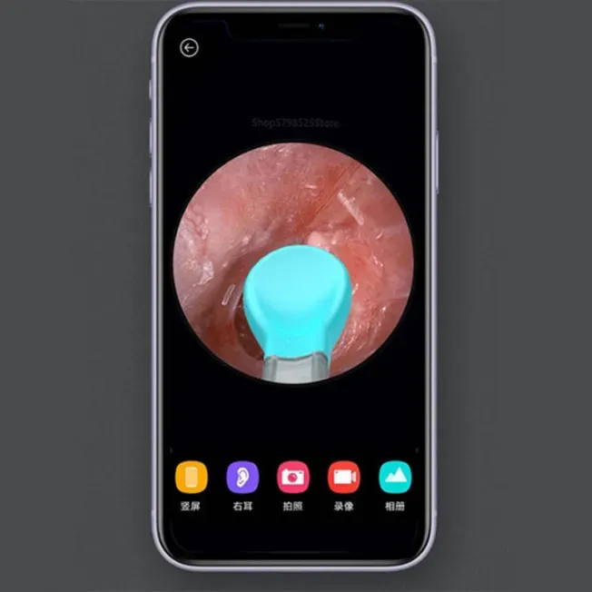 گوش پاک‌کن هوشمند شیائومی BEBIRD مدل Xiaomi M9 Pro image gallery